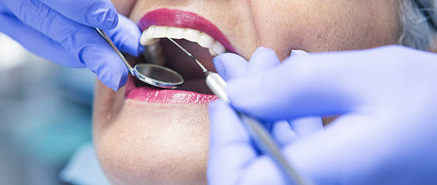 Best Urgent Care for Lost Fillings or Crowns in Boonville, CA